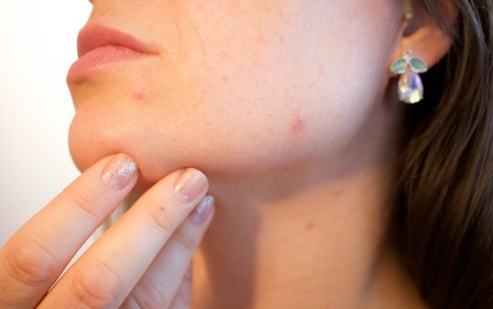Undgå hudproblemer med effektiv hudpleje